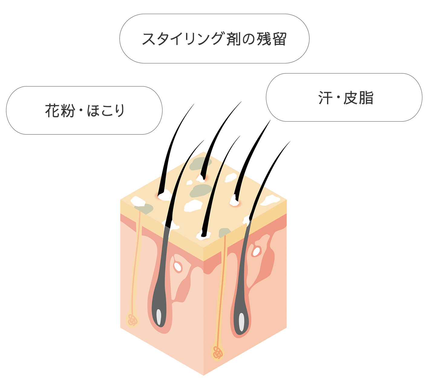 汚れた頭皮と髪